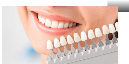 Clinica Dra. Kariny Werle - Lentes de Contato Dental em São Paulo